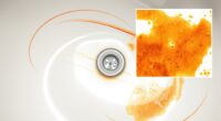 oxalic acid for rust